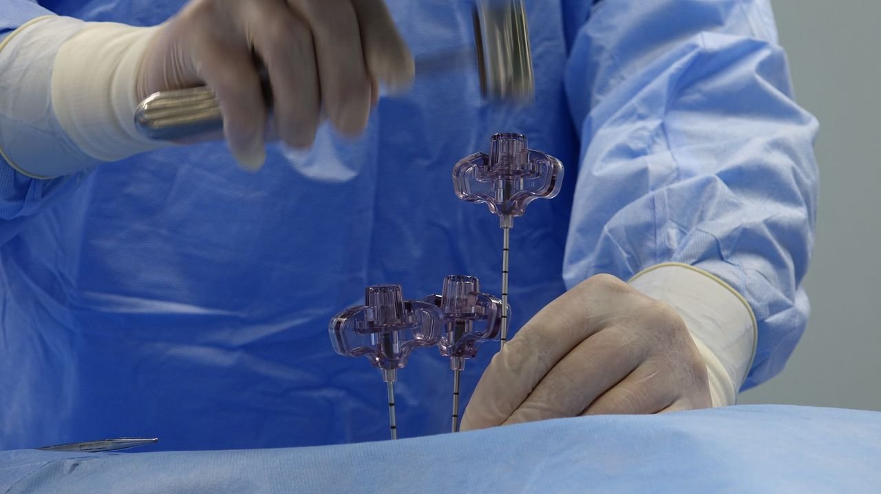 Close-up of sterile surgical procedure with instruments and gloved hands.