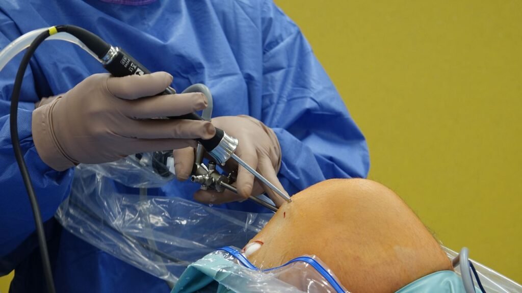pexels photo 30964506 Surgeon using arthroscope for precise knee surgery in operating room.